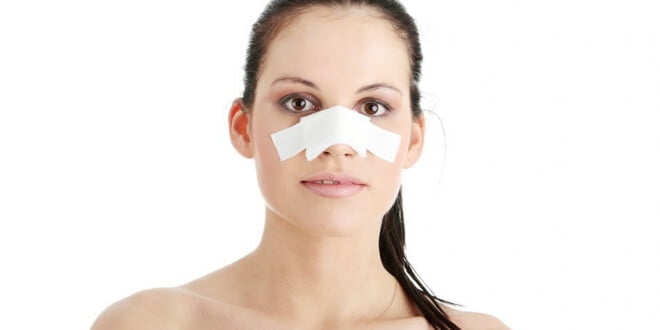 5 Tips for Your Rhinoplasty Recovery 1